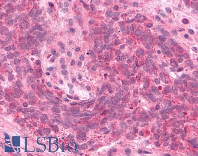 PathPlus™ DUSP26 / MKP8 Antibody (C-Terminus)
