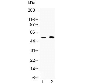 Yo / CDR2 Antibody