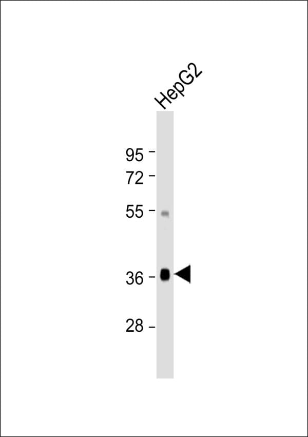 GHITM Antibody