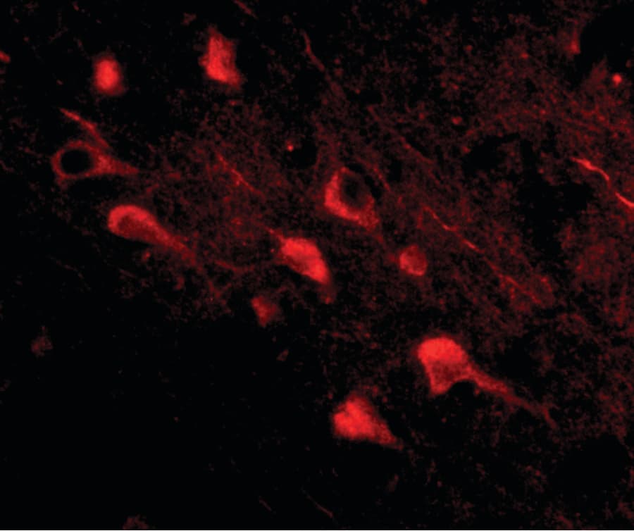 Polyclonal Rabbit anti-Human SLITRK5 Antibody (IHC, IF, WB)
