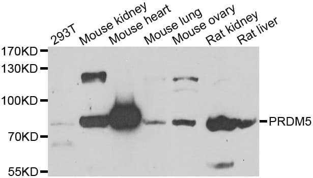 PRDM5 Antibody
