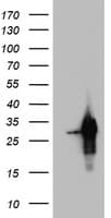 PRX-1 / PRRX1 Antibody (clone OTI2B2)