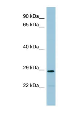 NAT8B Antibody (aa107-156)