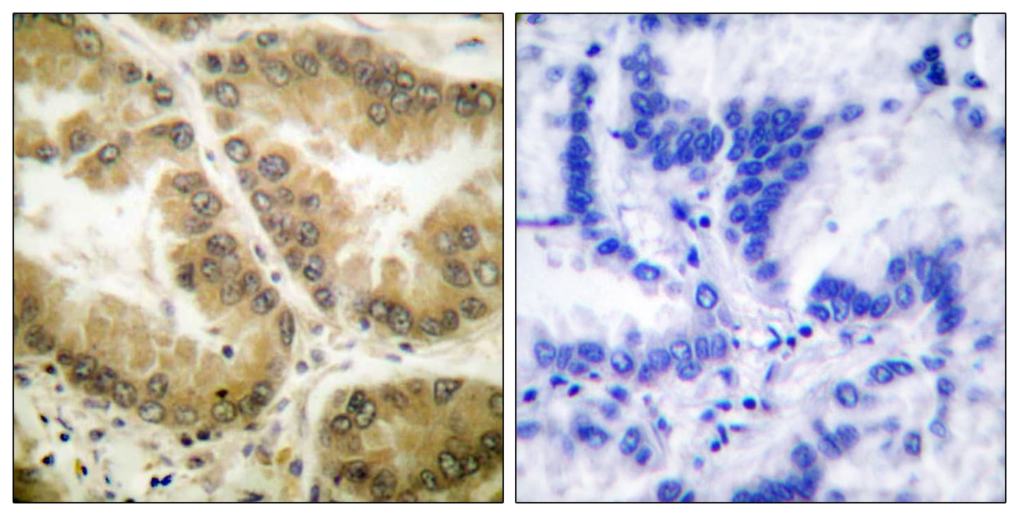 HDAC7 Antibody (aa901-950)