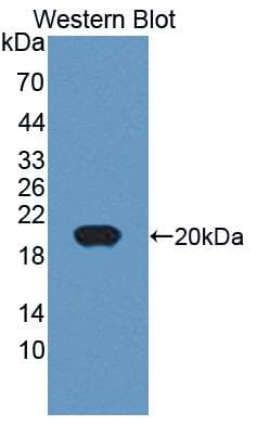 CD74 / CLIP Antibody