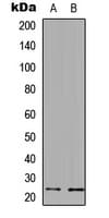UBE2E3 Antibody (C-Terminus)