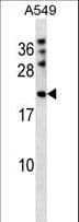 MPHOSPH6 Antibody (aa1-30)