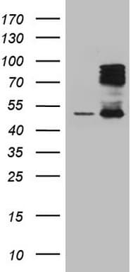 HIPK1 Antibody (aa439-697, clone OTI4B7)