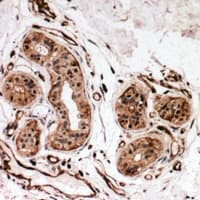 CAMK2G / CaMK II Gamma Antibody