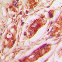 Polyclonal Rabbit anti-Human Vimentin Antibody (C-Terminus, IHC, IF, WB)