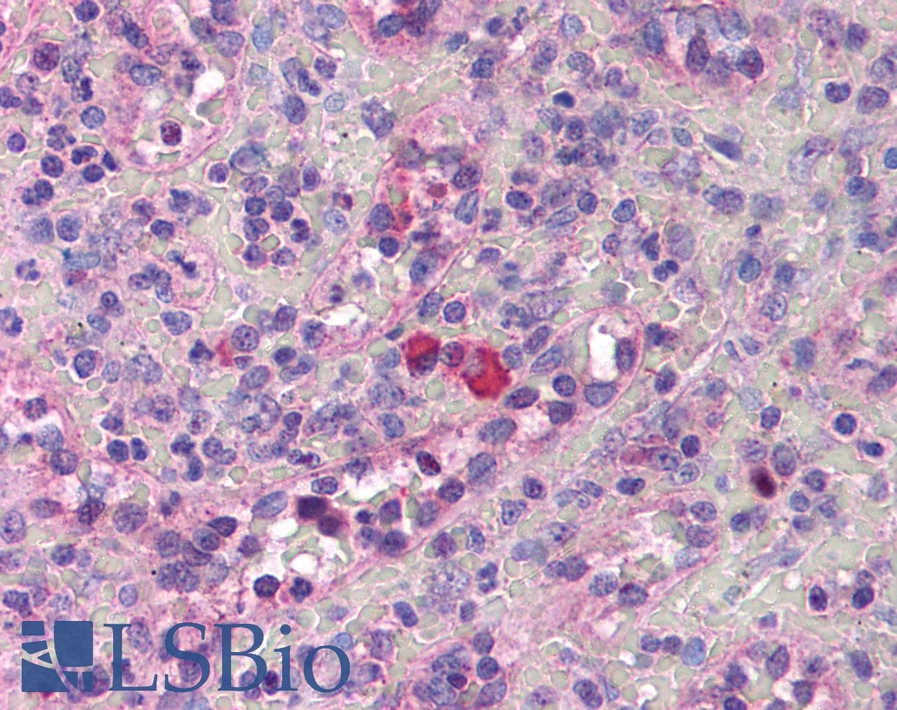 IHC-plus™ THPO / TPO / Thrombopoietin Antibody (aa35-50)
