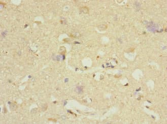 DNAJB2 Antibody