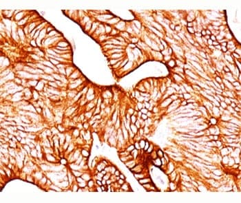 KRT8 / CK8 / Cytokeratin 8 Antibody (clone TS1, Ready-to-Use)