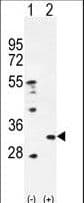 PRDX4 / Peroxiredoxin 4 Antibody (aa82-110)