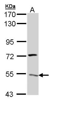 ATP6V1H Antibody (aa169-444)