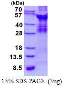 Human ABI3 Protein (Recombinant His)