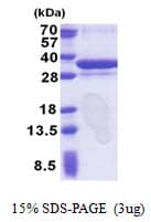 Human ORC6 / ORC6L Protein (Recombinant His)