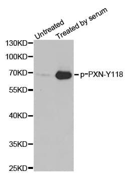 PXN / Paxillin Antibody (phospho-Tyr118)