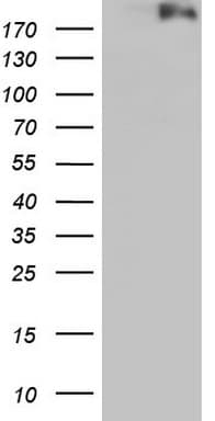 DOT1L / DOT1 Antibody (aa1-434, clone OTI2B10)