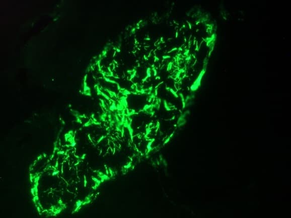 PathPlus™ KRT8 / CK8 / Cytokeratin 8 Antibody (clone 35-beta-H11)