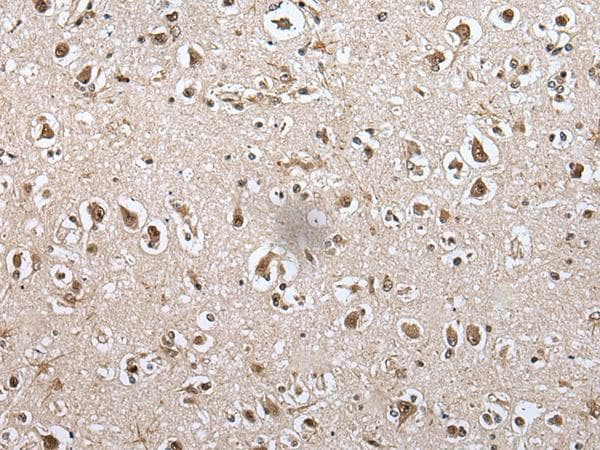 MAP1D Antibody
