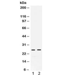 GSTA1+GSTA2+GSTA3+GSTA4+GSTA5 Antibody