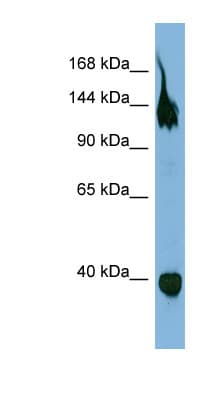 SEMA6A / Semaphorin 6A Antibody (aa359-408)