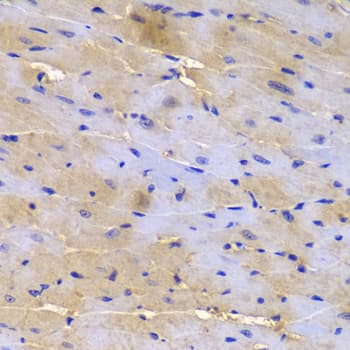 SGCE Antibody