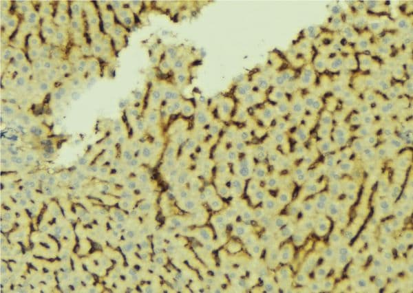 CETP Antibody