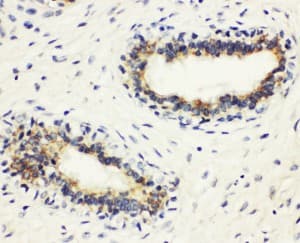 HLA-DMB Antibody (aa81-100)
