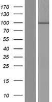 Human DCDC5 Protein (Over-Expression Lysate Myc-DDK (Flag))