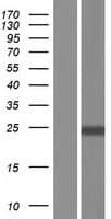 SCN1B Protein (Over-Expression Lysate Myc-DDK (Flag))