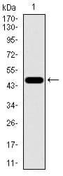 FOXC2 Antibody (aa21-210, clone 1D11C8)