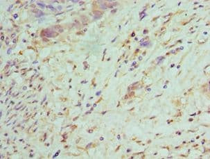 TRADD Antibody (aa1-312)