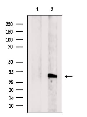 COQ5 Antibody
