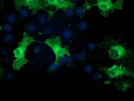 PRKCE / PKC-Epsilon Antibody (clone OTI4G8)