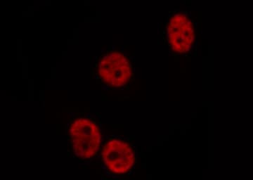 MSX2 / MSH Antibody