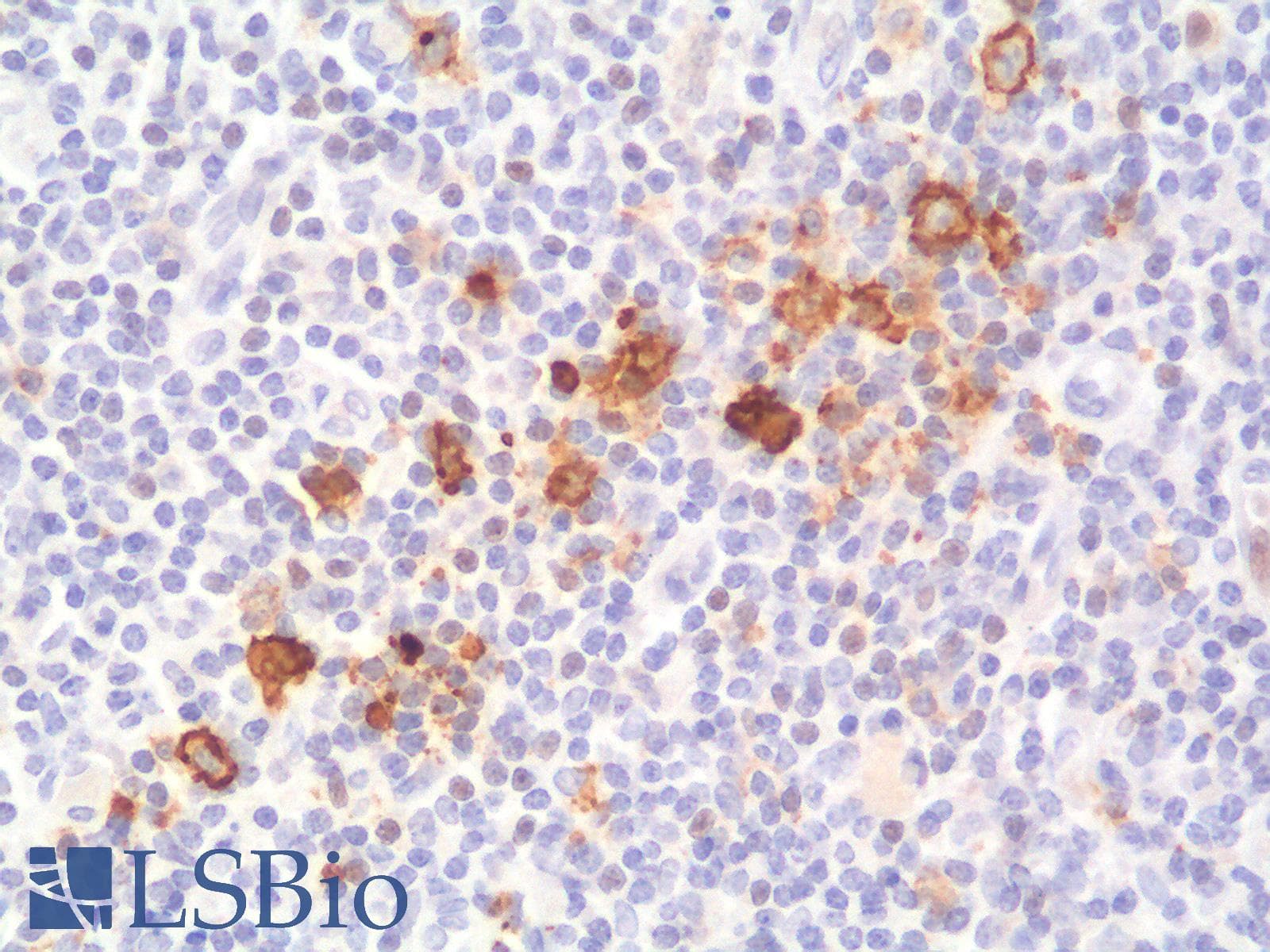 IHC-plus™ CD30 Antibody (clone rCD30/412)