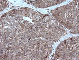 MAP2K1 / MKK1 / MEK1 Antibody (clone OTI3H3)