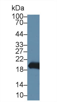 GKN2 / Gastrokine 2 Antibody (aa21-184, FITC)