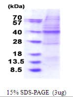 Human OSGEP Protein (Recombinant His)