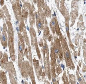 Polyclonal Rabbit anti-Human Tyrosinase Antibody (IHC, IF, WB)