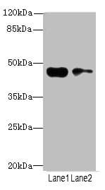 Polyclonal Rabbit anti-Human CCNE2 / Cyclin E2 Antibody (IHC, WB)