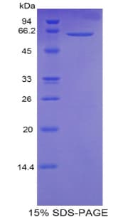Human CALM1 / Calmodulin Protein (Recombinant His-MBP)