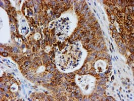 PSMB9 Antibody (clone OTI1G7)