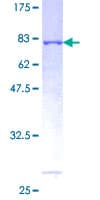Human STX18 / Syntaxin 18 Protein (Recombinant GST)