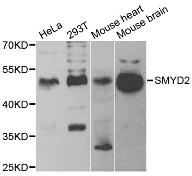 SMYD2 Antibody
