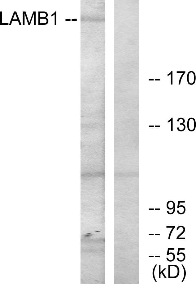 LAMB1 / Laminin Beta 1 Antibody