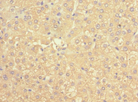 Polyclonal Rabbit anti-Human SCAD / ACADS Antibody (aa1-260, IHC, WB)