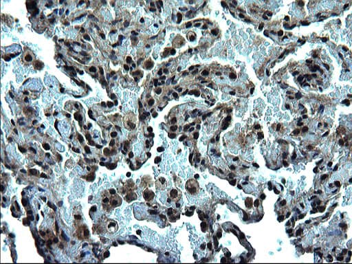 ZFAND3 / TEX27 Antibody (clone OTI1C5)
